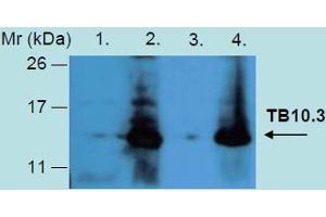 Western Blotting analysis of recombinant protein TB10. (Tb10.3 (M. Tuberculosis) 抗体)