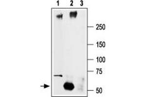 Immunoprecipitation of rat brain lysate: - 1. (SCN2A 抗体  (Intracellular))