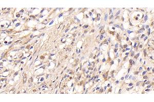 Immunohistochemistry (IHC) image for anti-Protein Kinase, AMP-Activated, alpha 1 Catalytic Subunit (PRKAA1) (AA 28-257) antibody (ABIN7440413)