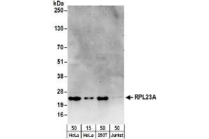 anti-Ribosomal Protein L23A (RPL23A) (AA 106-156) antibody