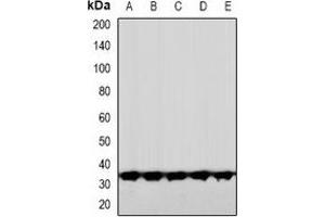 Western blot analysis of CNOT7 expression in HeLa (A), HuvEc (B), DKD (C), mouse brain (D), rat brain (E) whole cell lysates.