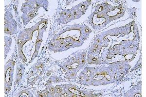 IHC analysis of Filamin B/FLNB using anti-Filamin B/FLNB antibody (ABIN7601607). (FLNB 抗体  (AA 397-701))