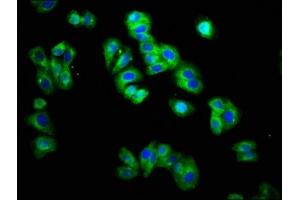 Immunofluorescence staining of HepG2 cells with ABIN7172182 at 1:166, counter-stained with DAPI. (TRHR 抗体  (AA 320-398))