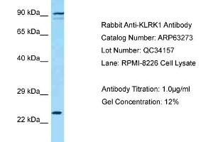 Western Blotting (WB) image for anti-Killer Cell Lectin-Like Receptor Subfamily K, Member 1 (KLRK1) (C-Term) antibody (ABIN2789431) (KLRK1 抗体  (C-Term))