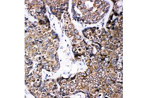 Immunohistochemistry (IHC) image for anti-ATP-Binding Cassette, Sub-Family B (MDR/TAP), Member 6 (ABCB6) (AA 818-842), (C-Term) antibody (ABIN3044283)