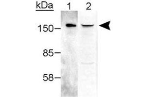 Western blot analysis of RAD50 in 25 ng purified hMre11-hRAD50 complex (Lane 1) and 25 ug crude HeLa extract (Lane 2 :) with RAD50 polyclonal antibody . (RAD50 抗体  (AA 628-787))