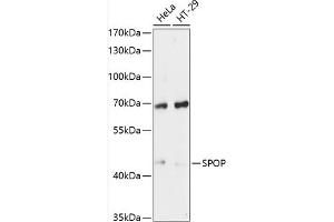 Western blot analysis of extracts of various cell lines, using SPOP antibody (ABIN6130702, ABIN6148373, ABIN6148375 and ABIN6215681) at 1:3000 dilution. (SPOP-B 抗体  (AA 175-374))