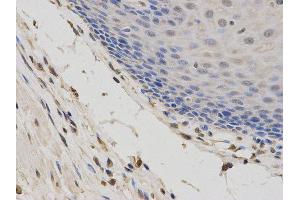 Immunohistochemistry (IHC) image for anti-Second Mitochondria-Derived Activator of Caspase (DIABLO) antibody (ABIN1872269) (DIABLO 抗体)