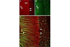 Immunohistochemistry (IHC) image for anti-Calcium Channel, Voltage-Dependent, P/Q Type, alpha 1A Subunit (CACNA1A) (AA 865-881), (Intracellular) antibody (ABIN7043006)