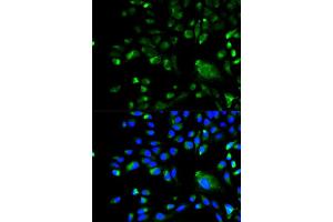 Immunofluorescence analysis of A549 cell using BCL10 antibody. (BCL10 抗体)