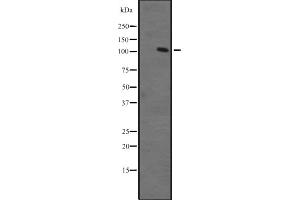 Western blot analysis of ZFPM1 expression in Ant fetal muscle lysate ;,The lane on the left is treated with the antigen-specific peptide. (ZFPM1 抗体  (Internal Region))