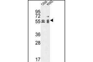 TBCE Antibody (Center) (ABIN653623 and ABIN2842978) western blot analysis in CEM,K562 cell line lysates (35 μg/lane).