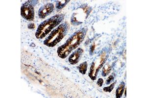 Immunohistochemistry (IHC) image for anti-Solute Carrier Family 12 (Potassium-Chloride Transporter) Member 2 (SLC12A2) (AA 223-241), (N-Term) antibody (ABIN3043994)