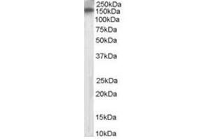 Image no. 1 for anti-Receptor Protein Tyrosine Phosphatase (PTPRT) (Internal Region) antibody (ABIN374470) (PTPRT 抗体  (Internal Region))