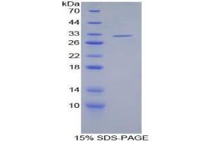 SDS-PAGE analysis of Human S Antigen Protein.