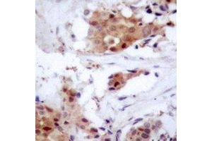 Immunohistochemistry (IHC) image for anti-Nucleoporin 62kDa (NUP62) antibody (ABIN7308108) (NUP62 抗体)
