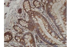 Image no. 2 for anti-Ribosomal Protein L19 (RPL19) (AA 1-101) antibody (ABIN465969) (RPL19 抗体  (AA 1-101))