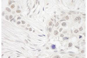 Immunohistochemistry (IHC) image for anti-NSL1, MIND Kinetochore Complex Component, Homolog (NSL1) (AA 150-200) antibody (ABIN7448510)