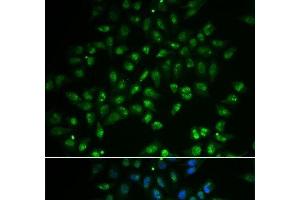 Immunofluorescence analysis of A549 cells using HAND2 Polyclonal Antibody (HAND2 抗体)