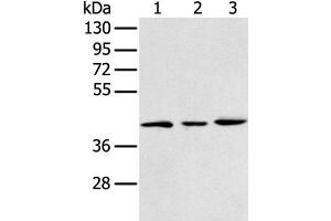 Western blot analysis of 293T K562 and Raji cell using DCX Polyclonal Antibody at dilution of 1:400 (Doublecortin 抗体)