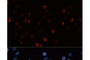 Immunofluorescence analysis of HeLa cells using DNMT3B Polyclonal Antibody at dilution of 1:100. (DNMT3B 抗体)