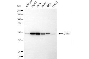 anti-serine Hydroxymethyltransferase 1 (Soluble) (SHMT1) antibody