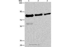Western blot analysis of Hela, LoVo and HepG2 cell, using FASTKD2 Polyclonal Antibody at dilution of 1:500 (FASTKD2 抗体)