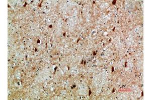 Immunohistochemical analysis of paraffin-embedded human-brain, antibody was diluted at 1:200 (NFAT5 抗体  (AA 1268-1341))