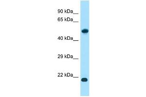 WB Suggested Anti-ALG10B Antibody Titration: 1. (ALG10B 抗体  (N-Term))