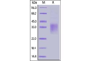 Human NKG2A, His Tag on  under reducing (R) condition. (KLRC1 Protein (AA 94-233) (His tag))