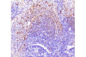 IHC analysis of Caspase-2 using anti-Caspase-2 antibody (ABIN6719550).