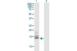Western Blot analysis of CCL28 expression in transfected 293T cell line by CCL28 monoclonal antibody (M03), clone 3A7.