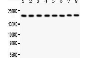 Anti- TJP1 antibody, Western blotting All lanes: Anti TJP1  at 0. (TJP1 抗体  (AA 1178-1527))