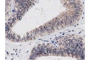 Image no. 7 for anti-Acyl-CoA Thioesterase 12 (ACOT12) antibody (ABIN1496414) (ACOT12 抗体)