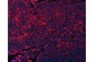 IF analysis of DOCK180/DOCK1 using anti-DOCK180/DOCK1 antibody (ABIN7599615).