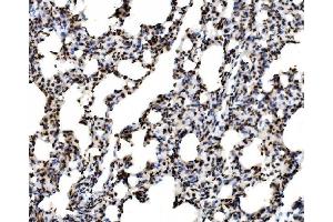 IHC analysis of SPHK1 using anti-SPHK1 antibody (ABIN7600168).