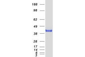Western Blotting (WB) image for Nudix (Nucleoside Diphosphate Linked Moiety X)-Type Motif 9 (NUDT9) (Transcript Variant 1) protein (Myc-DYKDDDDK Tag) (ABIN2727780)
