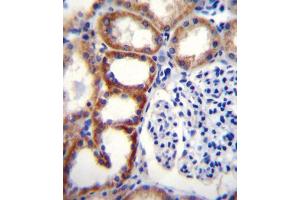 Immunohistochemistry (IHC) image for anti-Succinate Dehydrogenase Complex, Subunit D, Integral Membrane Protein (SDHD) antibody (ABIN2996554) (SDHD 抗体)