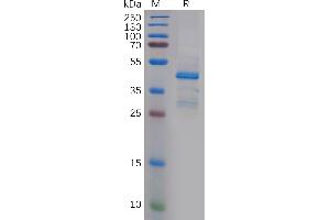 SDS-PAGE (SDS) image for Pleiotrophin (PTN) (AA 33-168) protein (Fc Tag) (ABIN7092750)