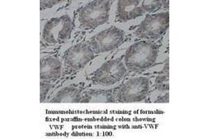 Image no. 1 for anti-Von Willebrand Factor (VWF) (Internal Region) antibody (ABIN791020) (VWF 抗体  (Internal Region))