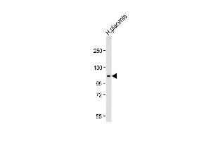 Western blot analysis of lysate from Jurkat cell line, using G Antibody (N-term) (ABIN656475 and ABIN2845755). (GAA 抗体  (N-Term))