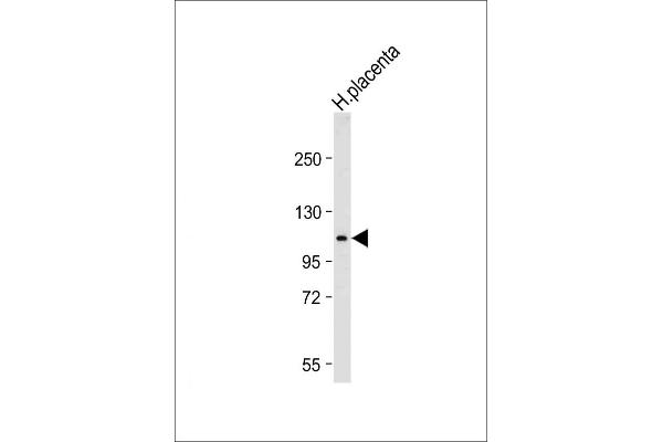 GAA antibody  (N-Term)
