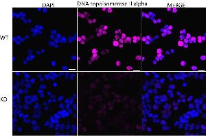 Immunocytochemical staining of HeLa cells using DNA topoisomerase II alpha antibody (ABIN7800574), 1:1,000), Top panel: wild-type (WT), Bottom panal: DNA topoisomerase II alpha shRNA knockdown (KD).