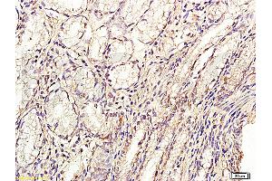 Formalin-fixed and paraffin embedded: human stomach tissue labeled with Anti-GLP-2 Polyclonal Antibody, Unconjugated (ABIN726305) at 1:200, followed by conjugation to the secondary antibody and DAB staining (GLP-2 抗体  (AA 146-165))