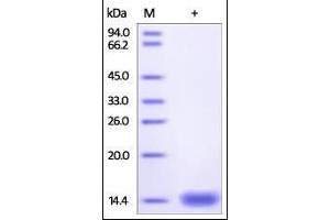 Cynomolgus beta 2-Microglobulin, His Tag on SDS-PAGE under reducing (R) condition. (beta-2 Microglobulin Protein (AA 21-119) (His tag))