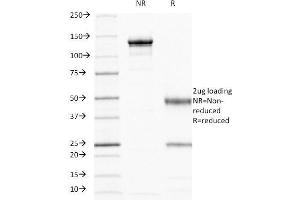 SDS-PAGE (SDS) image for anti-CD44 (CD44) antibody (ABIN6941197)