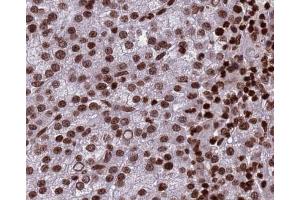 Histone H3 Antibody for IHC in human testis (Histone 3 抗体)