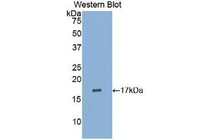 Western blot analysis of the recombinant protein. (LIFR 抗体  (AA 45-184))