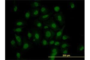 Immunofluorescence of monoclonal antibody to HIPK1 on HeLa cell. (HIPK1 抗体  (AA 330-430))