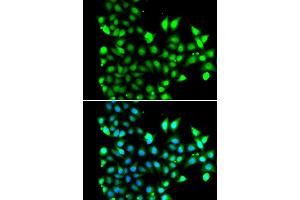 Immunofluorescence analysis of MCF7 cell using SNRPD2 antibody. (SNRPD2 抗体)